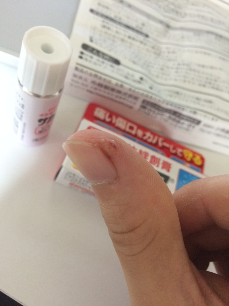 f:id:jimpeipei:20150828154442j:plain f:id:jimpeipei:20150828154442j:plain